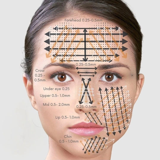 Microneedling Depth Guide for Different Areas of Your Face